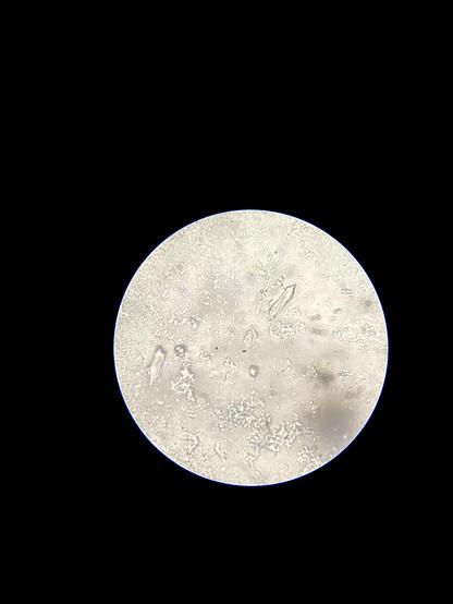 A couple of Paramecium and probably some ciliates? I don’t know.