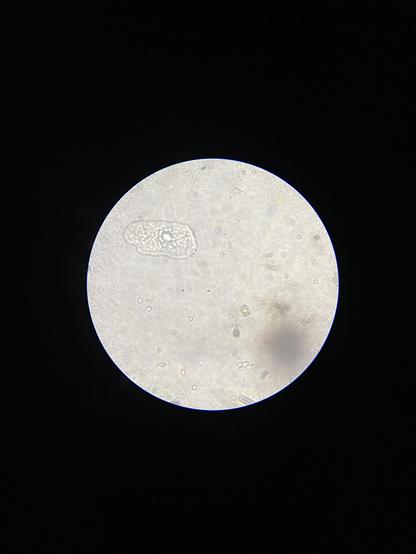 100% definitely an amoeba.