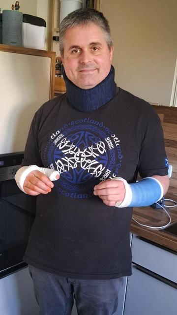 Ein Foto von mir mit zwei eingegipsten Armen und Halskrause.