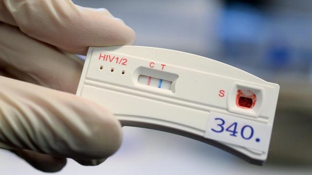 Epidemien: Hepatitis, Aids, Syphilis & Tripper werden in Europa zunehmend zum Problem
