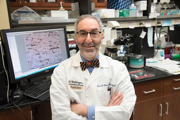 Understanding genetic factors behind a pediatric brain tumor - The Source