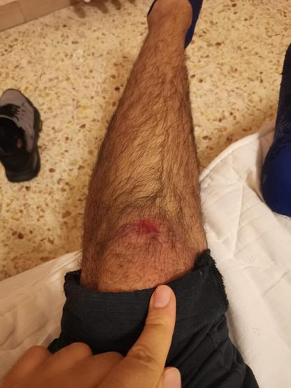 Knee recovery
