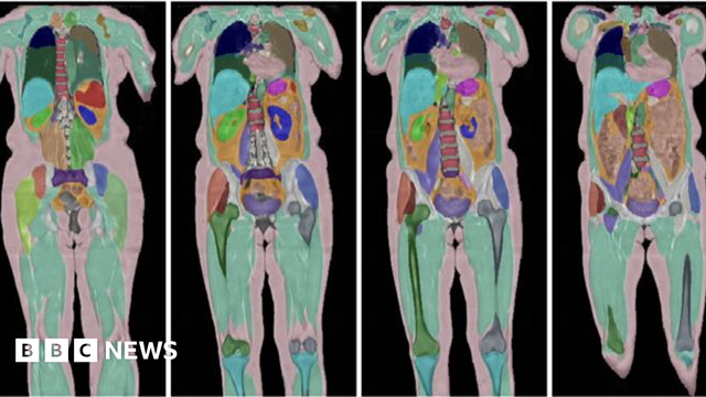 An image from the UK Biobank project. It shows for MRI scans of the body showing the legs and major organs including the heart, spine and stomach in different colours. An image from the UK Biobank project. It shows for MRI scans of the body showing the legs and major organs including the heart, spine and stomach in different colours.